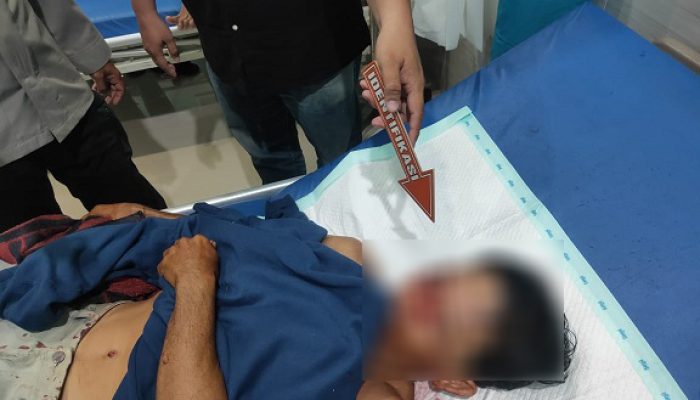 Baru Duduk di Teras, Pria di Bintan Dibacok Teman Sendiri Gara-Gara Wanita