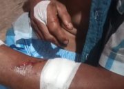 Cari Ketam, Warga Tanjungpinang Malah Digigit Buaya Hingga 24 Jahitan!