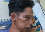 Klarifikasi Kasus Irwansyah: Keluarga Bantah Kecelakaan, Sebut Dianiaya Brutal