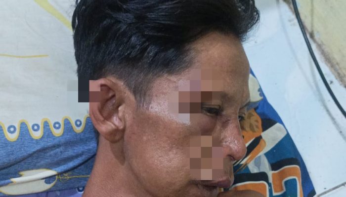 Klarifikasi Kasus Irwansyah: Keluarga Bantah Kecelakaan, Sebut Dianiaya Brutal