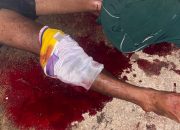 Colok Mata Buaya untuk Bertahan Hidup, Nelayan Bintan Akhirnya Selamat
