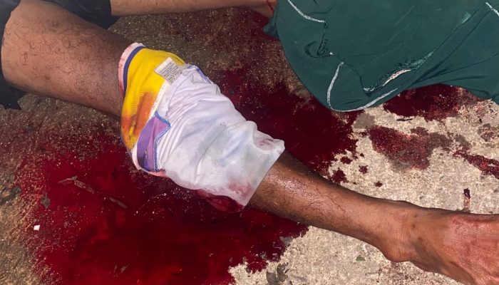 Colok Mata Buaya untuk Bertahan Hidup, Nelayan Bintan Akhirnya Selamat